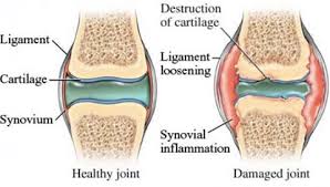 Horse joint supplements